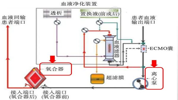 ECMO是什么意思,ecmo英语怎么读,ecmo为什么这么贵